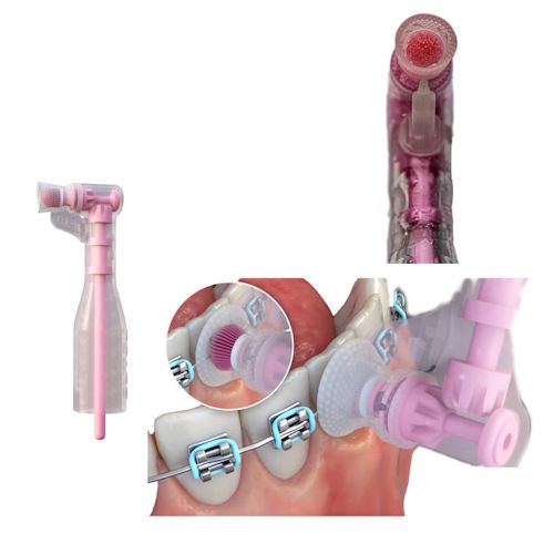 BUNDLE 3 + 1 Free: <br>Lotus Ortho Brush Cup LSFAB-100 (Box of 100) - Image 3
